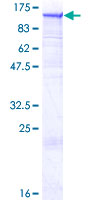 12.5% SDS-PAGE Stained with Coomassie Blue.